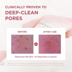 Alternative view of centella poremizing deep cleansing foam skin1004 125ml