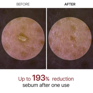 Alternative view of DR.MELAXIN PEEL SHOT EXFOLIATING RICE WHITE AMPOULE