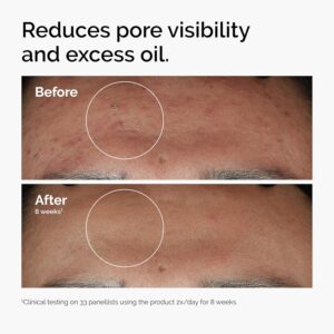 The Ordinary Niacinamide 10 Percent Zinc 1 Percent Serum 30ml Bottle